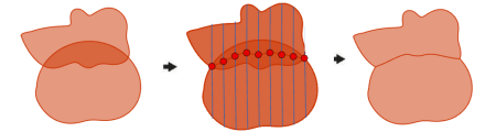 Méthode Carroyage