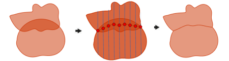 Méthode Carroyage